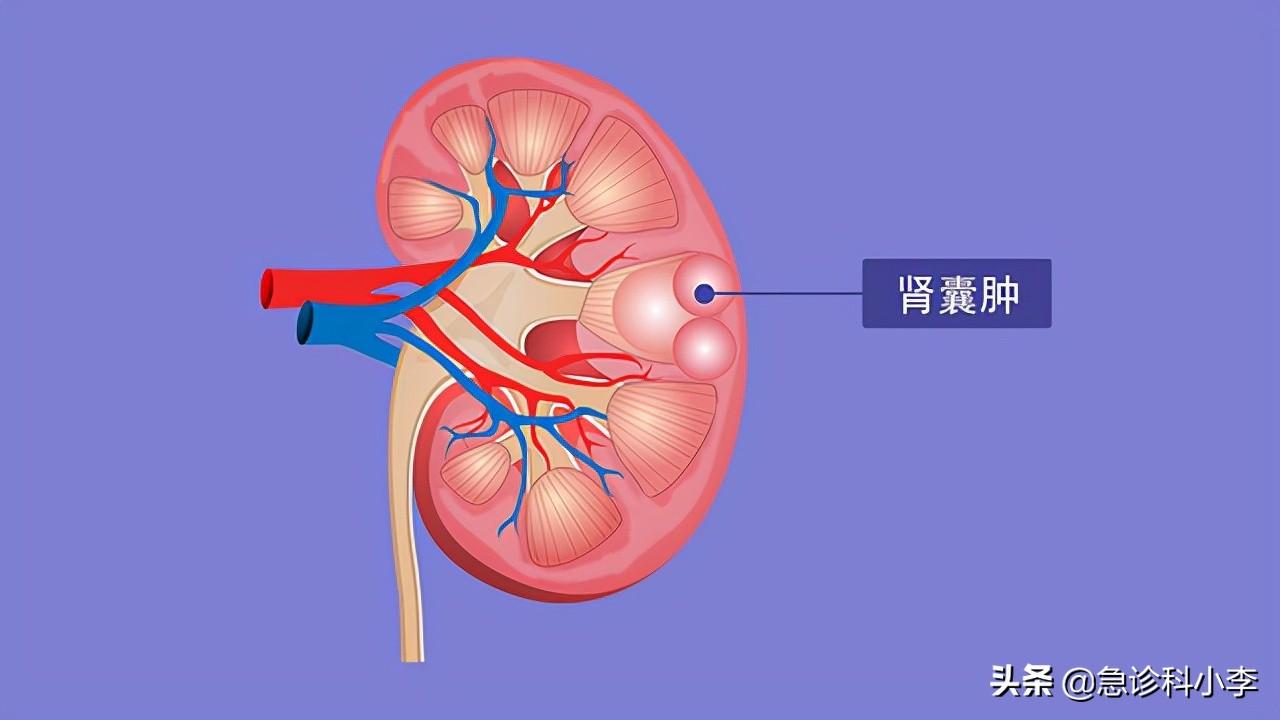 脂囊瘤最新治疗方法的研究与应用进展